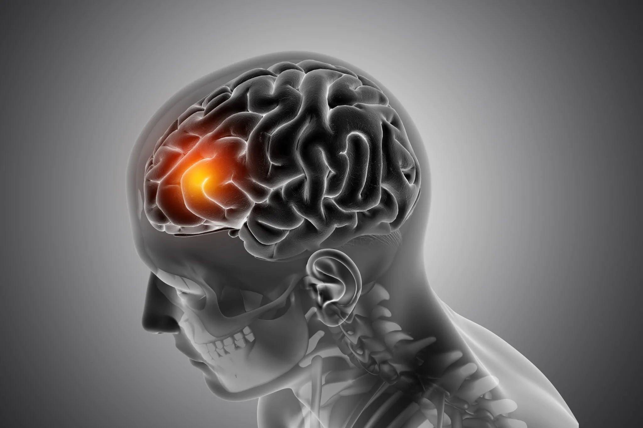 SÍNDROME DE CUSHING – EXCESSO DE CORTISOL NO CORPO - Bigens